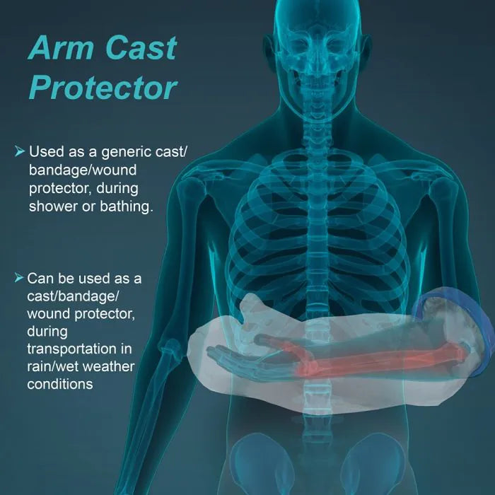 Tynor Cast Cover Arm C-19