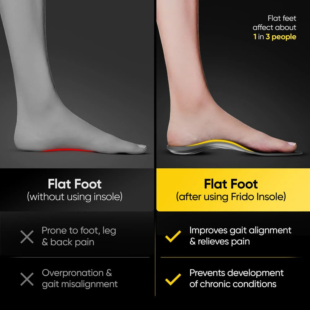 Frido Arch Support Insoles (Rigid)