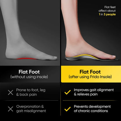 Frido Arch Support Insoles (Rigid)