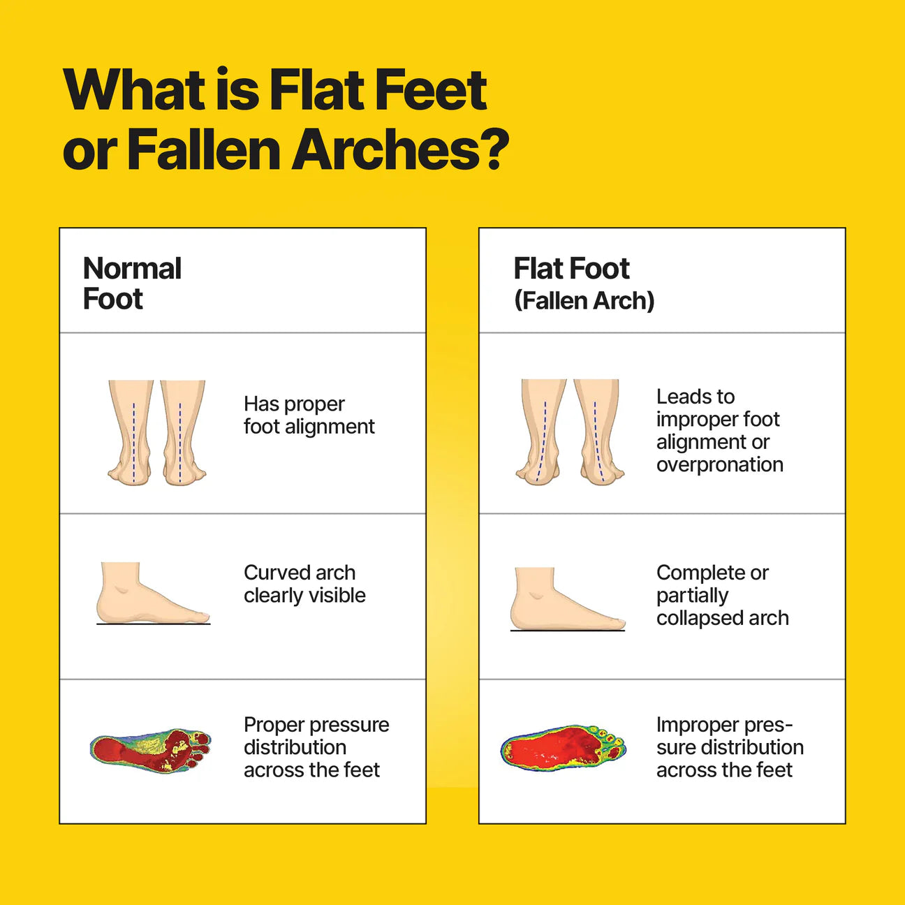 Frido Arch Support Insoles (Semi-Rigid)